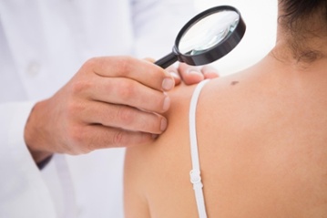 Doctor examining a mole with magnifying glass