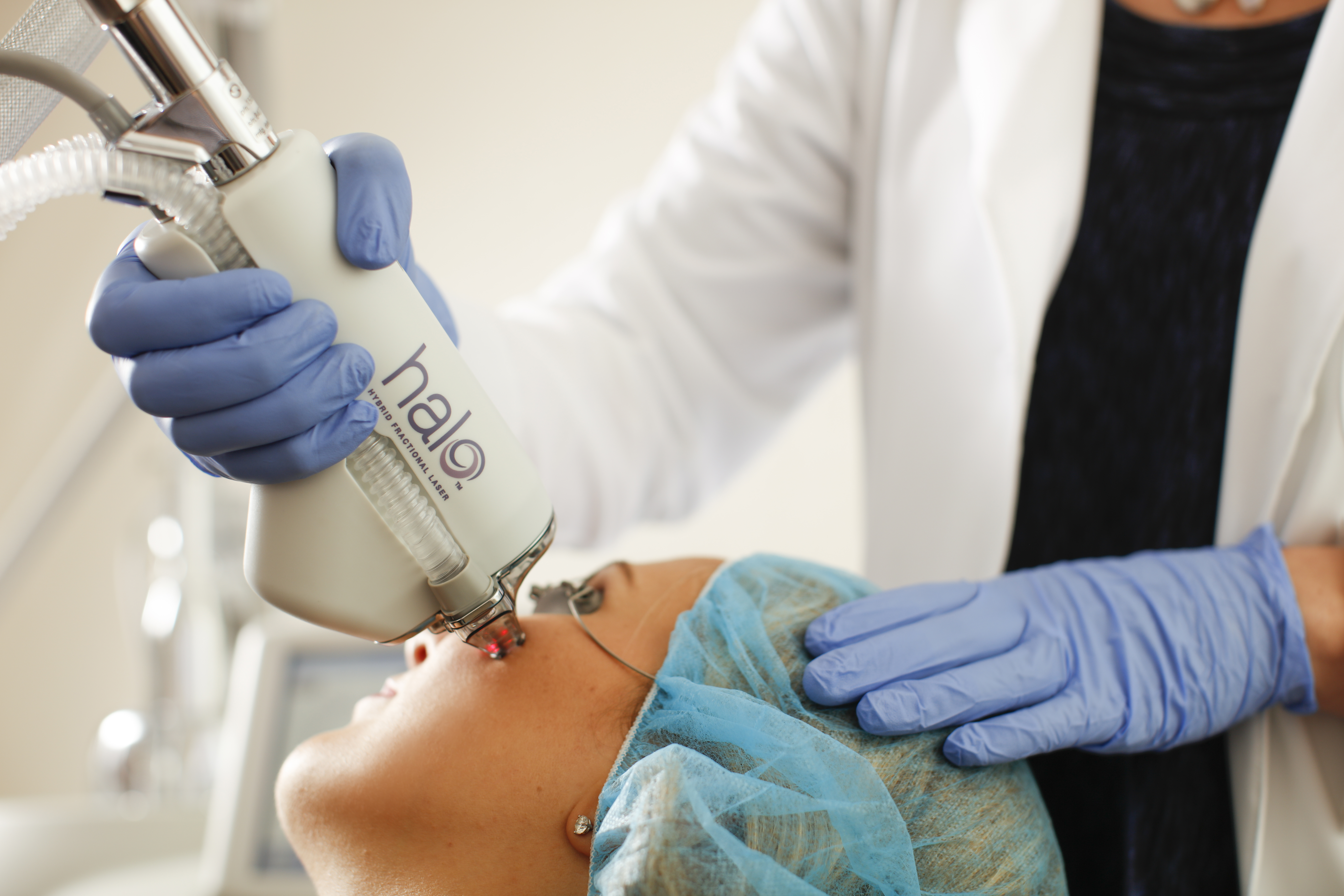 The Halo hybrid fractional laser devise is applied to a patient's face for laser skin resurfacing.