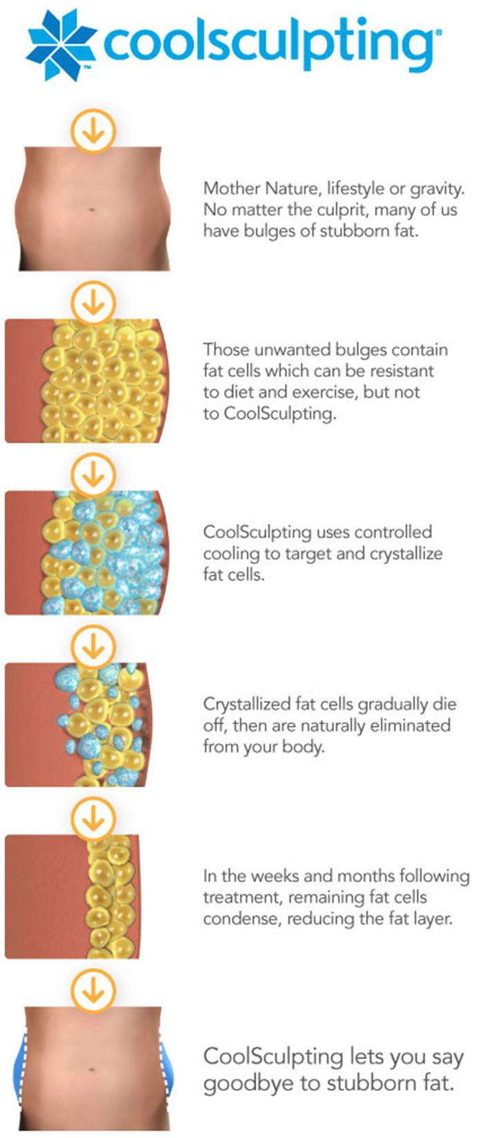 Illustration of how the fat cells look and react to a CoolSculpting treatment.