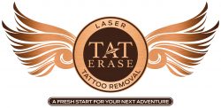 Tat Erase logo, laser tattoo removal, and the tagline: a fresh start for your next adventure.