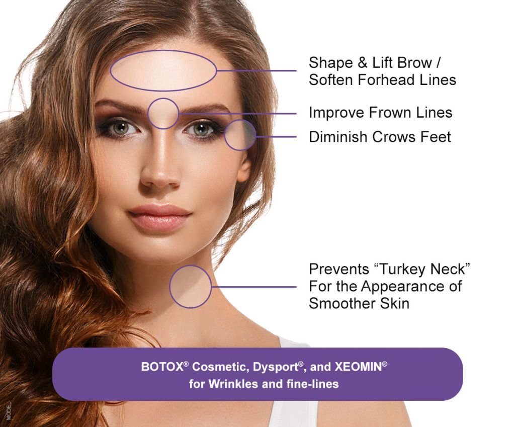 Diagram displaying the areas BOTOX helps treat