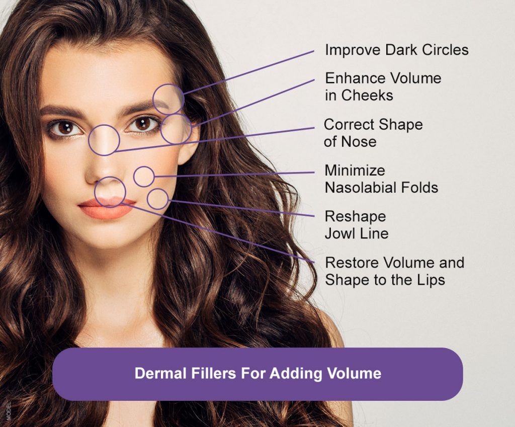Diagram displaying the areas fillers help treat