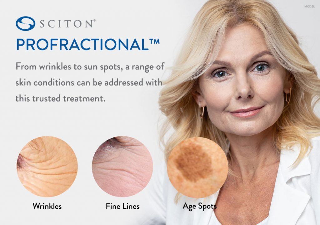 Sciton profractional ad