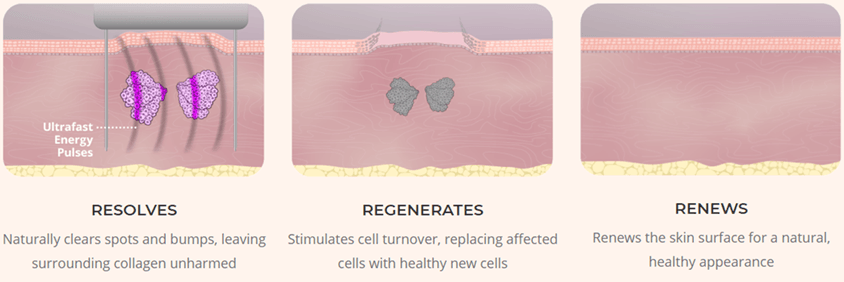 Three steps of CellFX, Resolves, Regenerates, and Renews.