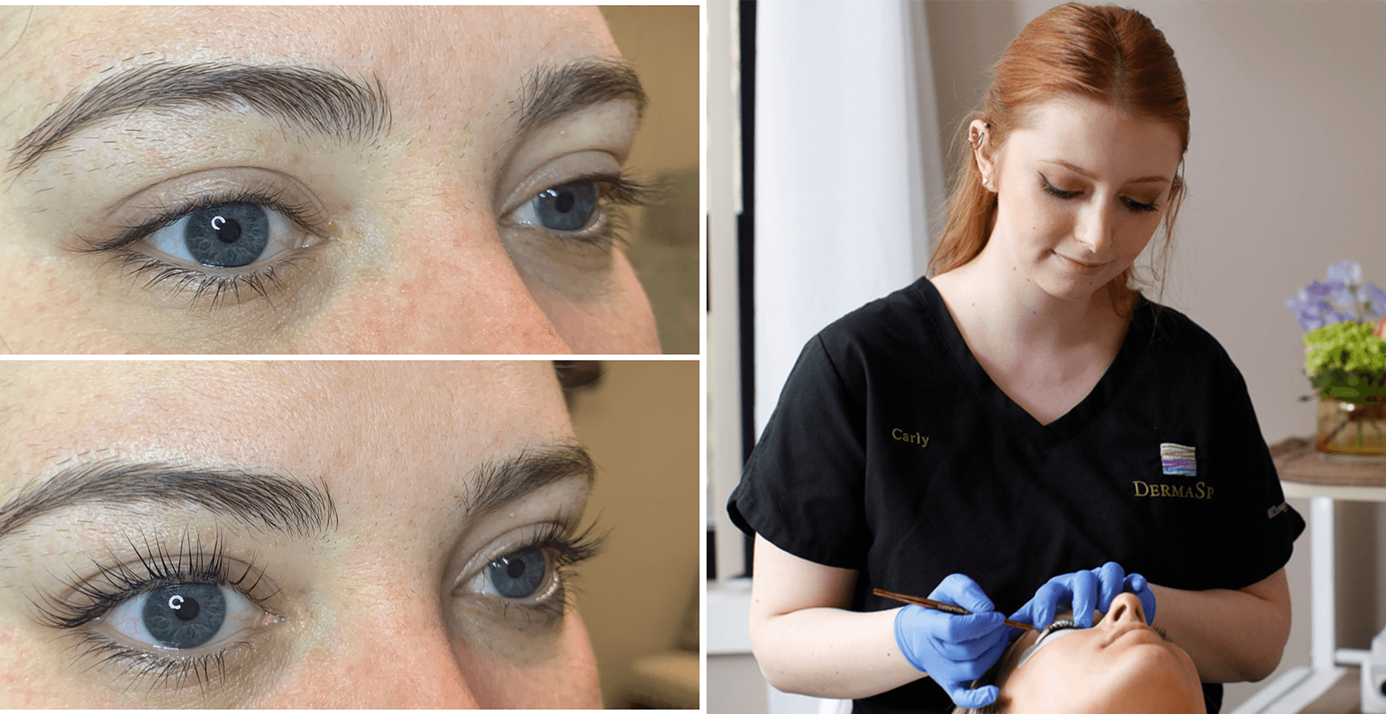 Eyelash Extension Alternative in Rochester, NY Dermatology Associates