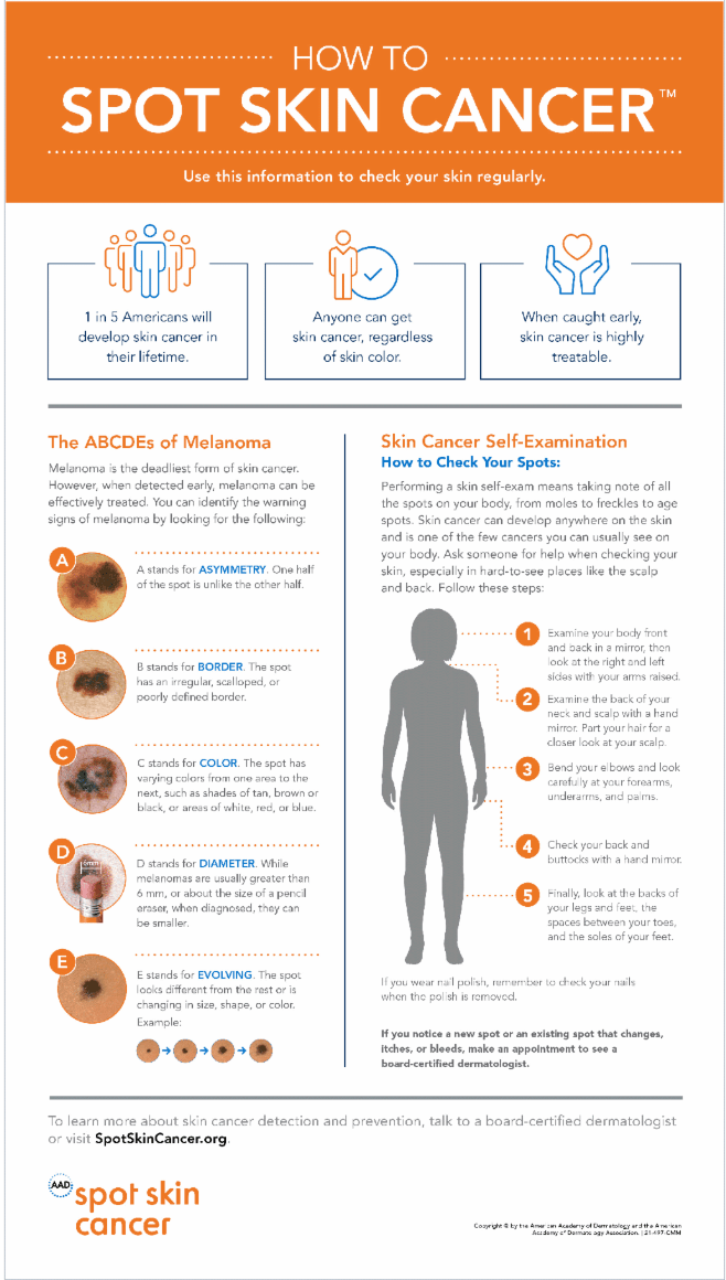 How to spot skin cancer infographic