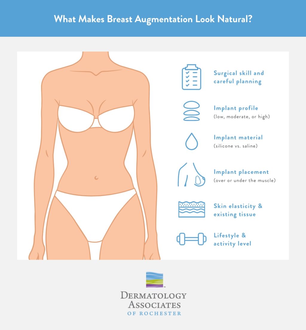 An infographic explaining the elements that contribute to natural-looking breast augmentation, including surgical skill and  careful surgical planning, implant details, and lifestyle. 
