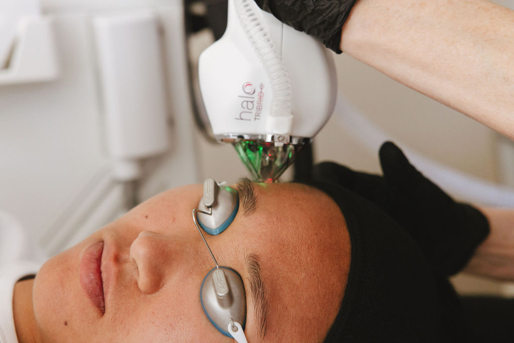 HALO TRIBRID treatment